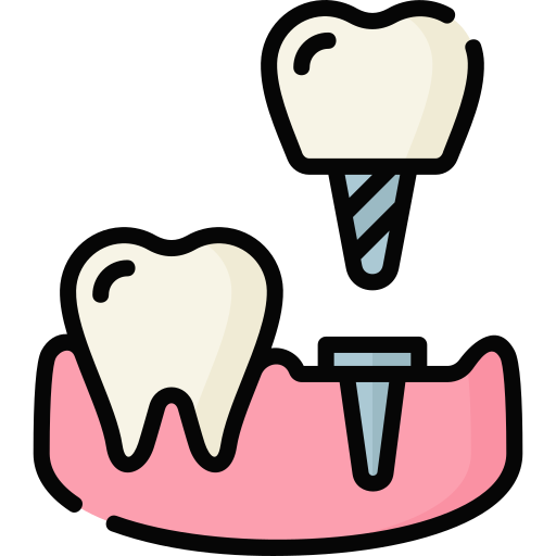 Dental Implant techniques